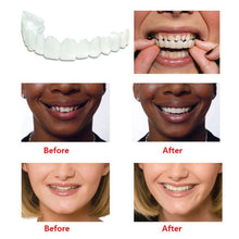 Load image into Gallery viewer, Whitening Snap On Smile Perfect Smile Fits Most Comfortable Denture Care False Dental Teeth Veneers Upper Teeth &amp; Lower Teeth